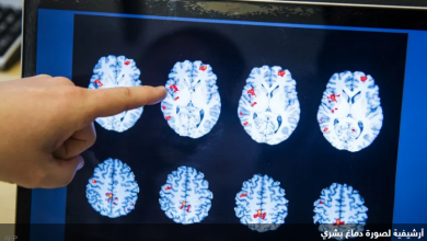 صورة دولة آسيوية تسجل إصابة بـ”مرض فتاك” يدمر دماغ البشر