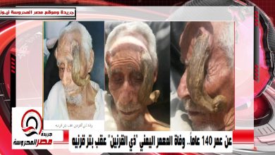 صورة عن عمر 140 عاماً.. وفاة المعمر اليمني “ذي القرنين” عقب بتر قرنيه